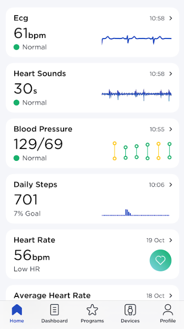 Withings announces availability of ECG-taking BPM Core & updated BPM Connect