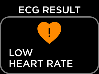 ECG_RESULT_NSR-20-_low_HR.png