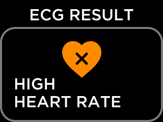 ECG_RESULT_NSR-3_-_High_HR.png