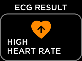 ECG_RESULT_NSR-6_-_High_HR_No_Afib.png