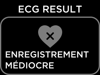 FR-ECG_RESULT_NSR-12.png