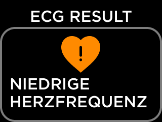 DE-ECG_RESULT_NSR-5.png