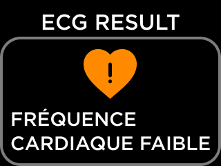 FR-ECG_RESULT_NSR-4.png