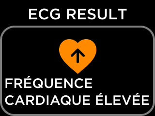 FR-ECG_RESULT_NSR-2.png
