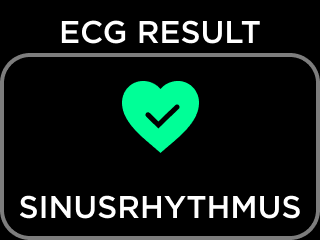 DE-ECG_RESULT_NSR-1.png
