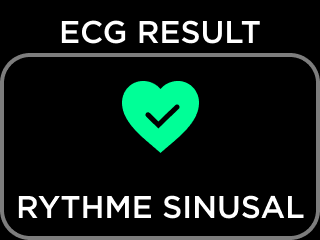 FR-ECG_RESULT_NSR.png