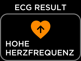 DE-ECG_RESULT_NSR-3.png