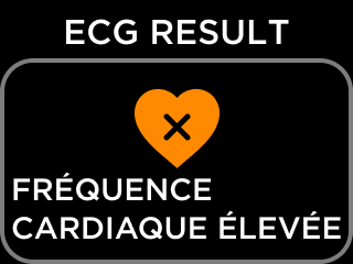 FR-ECG_RESULT_NSR-6.png