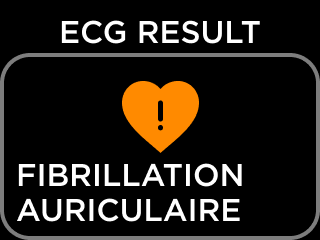 FR-ECG_RESULT_NSR-8.png