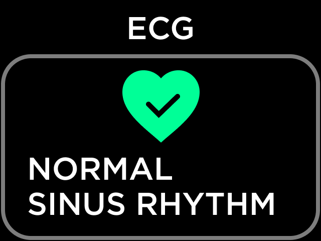 Body Scan - Activating the ECG feature – Withings