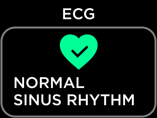 Body Scan - Activating the ECG feature (U.S. Only) – Withings