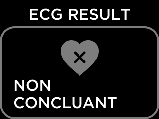 FR-ECG_RESULT_NSR-10.png