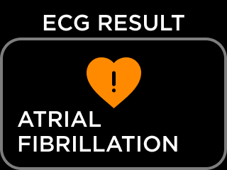 ECG_RESULT_NSR-4_-_AFib.png