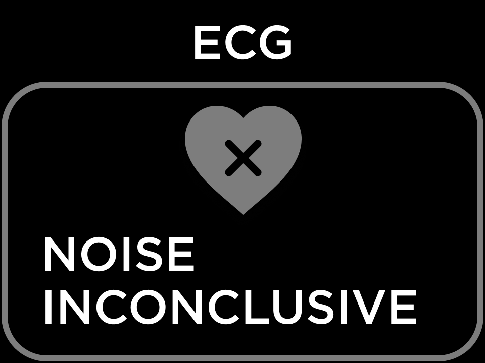 ECG RESULT INCONCLUSIVE NOISE.png