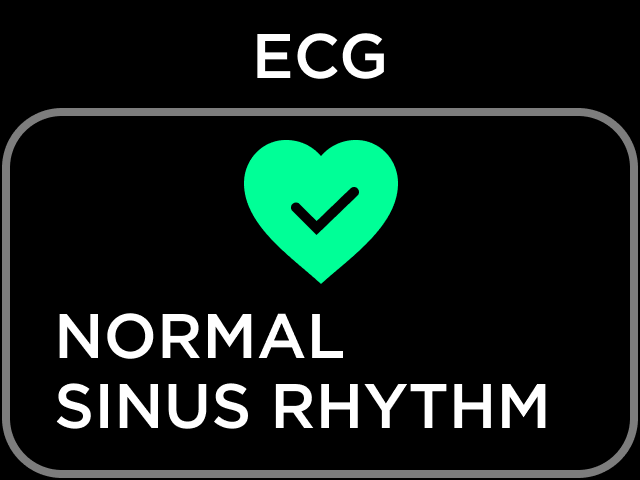 ECG RESULT NSR.png