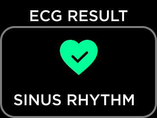 ECG_RESULT_NSR_-_Sinus_Rhythm.png
