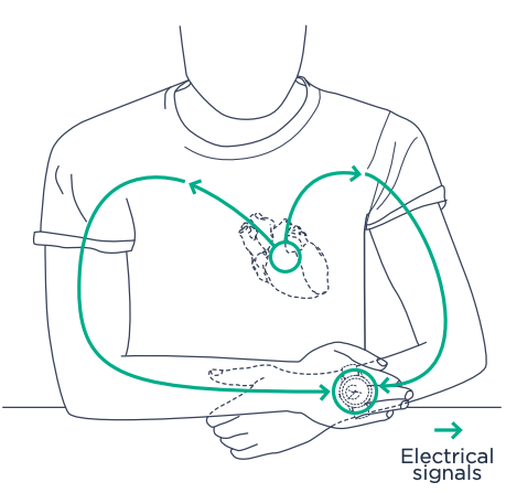 moveecg-position.png