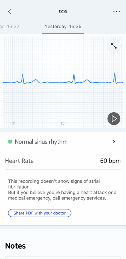 ecg-measurement-done.png