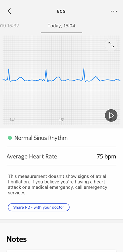 ecg-measurement-graph-ok.png