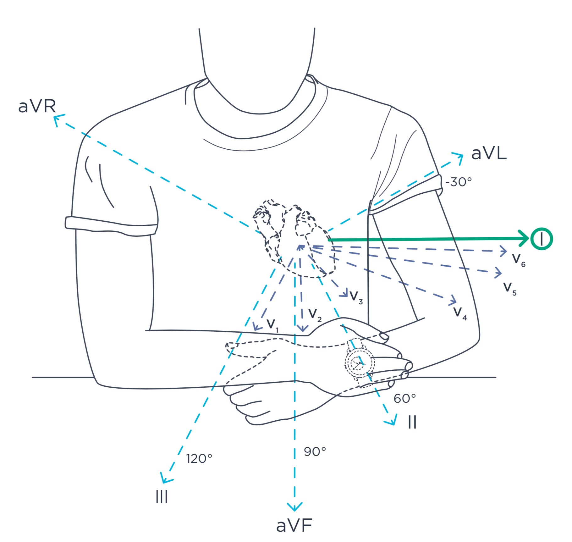 ecg-illus.jpg