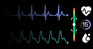 New_ECG.png