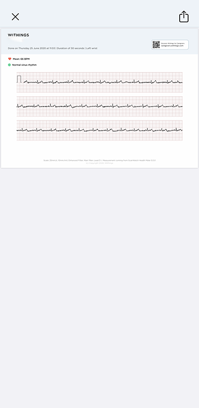 ScanWatch - Sharing My ECG Recordings With My Doctor – Withings | Support