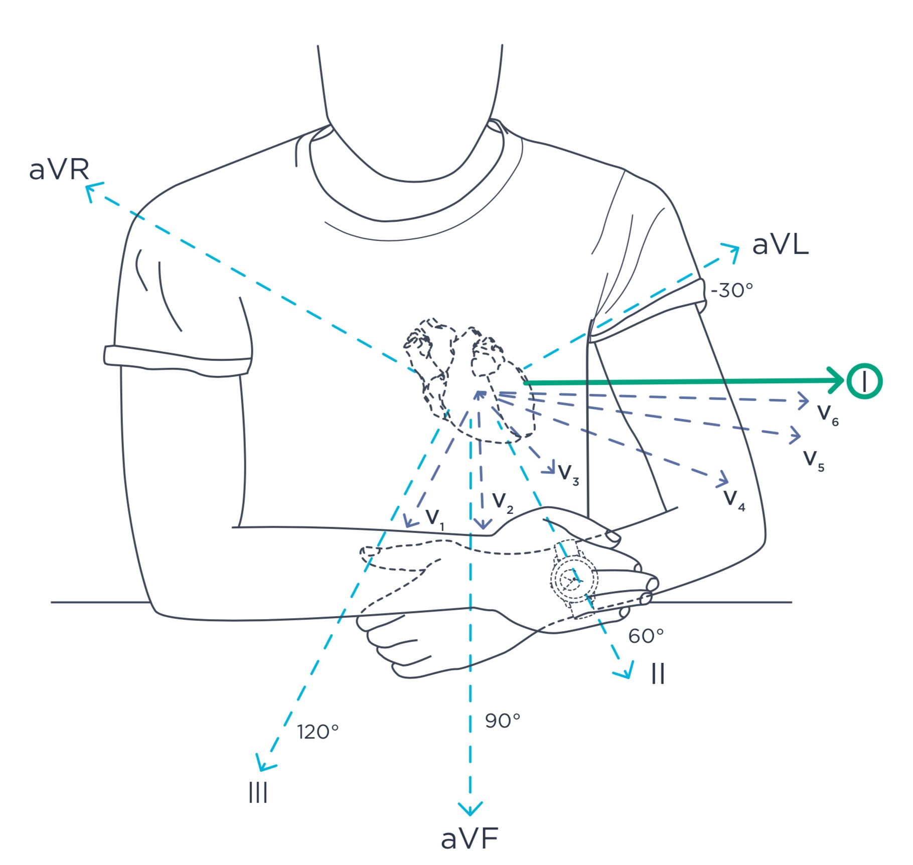 withings scanwatch ecg