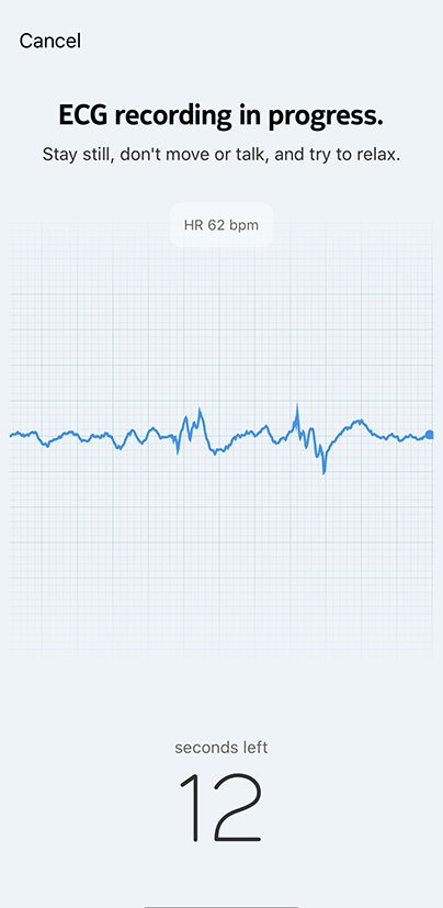 moveecg-ecg-progress.png