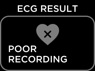 ECG_RESULT_NSR-5.png