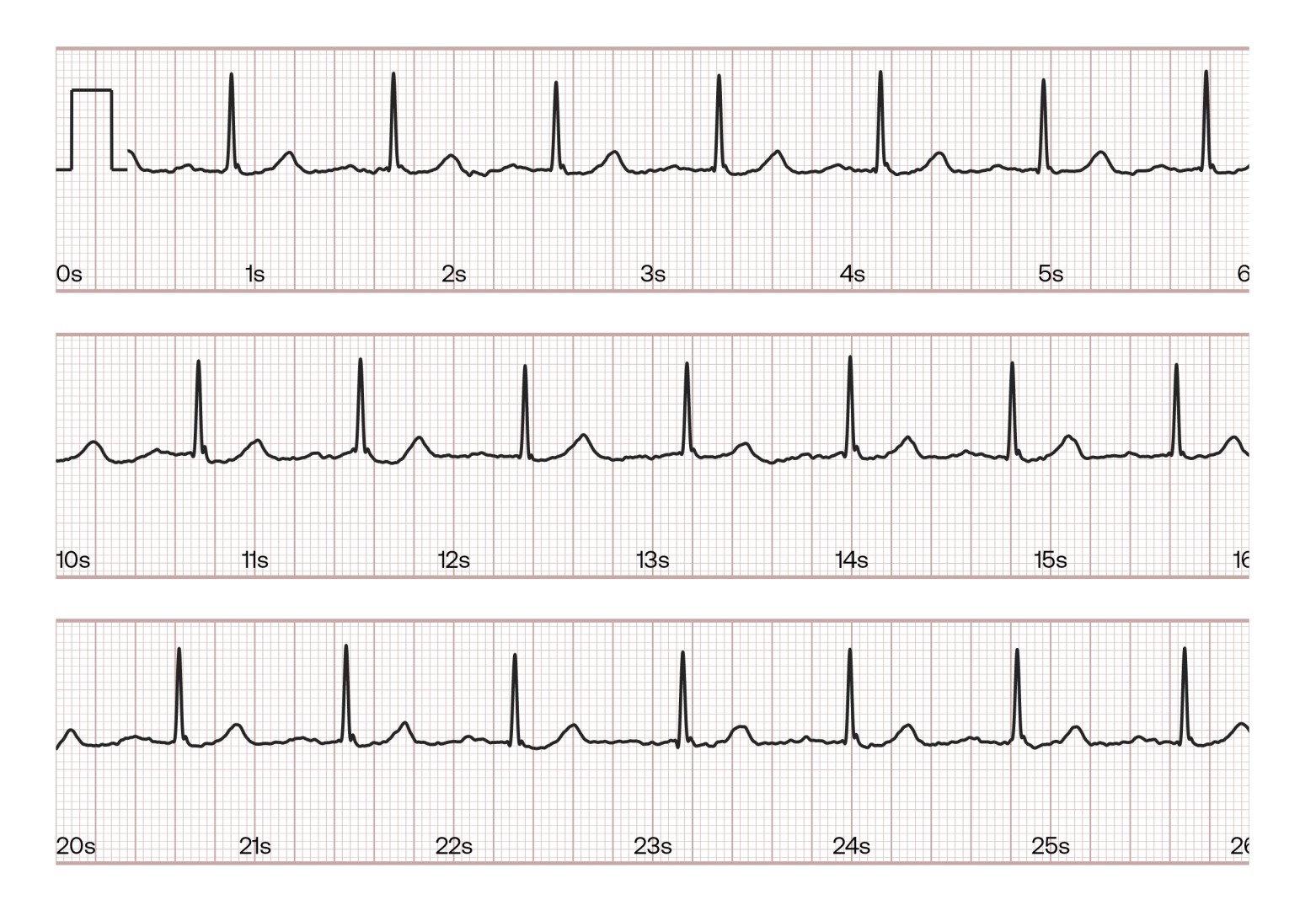 Como Hacer Un Pdf Ecg 1280x720